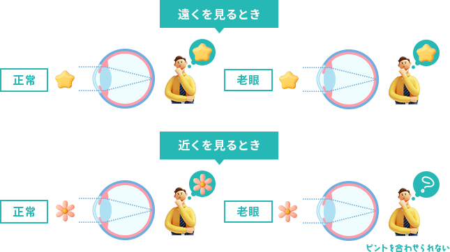 そもそも老眼とは？