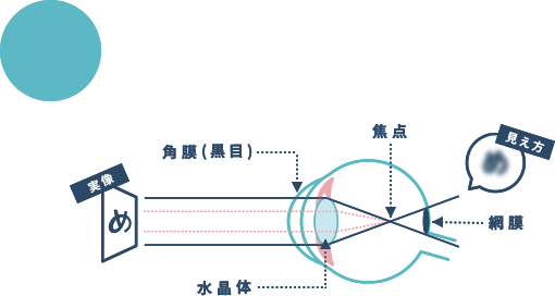 遠くが見えにくくなっている状態。近くのものはハッキリ見えます。