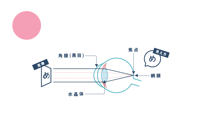 正視とは屈折異常がなく、あらゆる距離のものをはっきりと見ることができます。