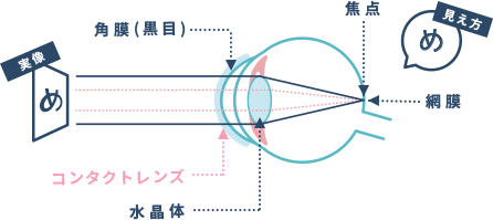 コンタクト装着で見やすくなりました
