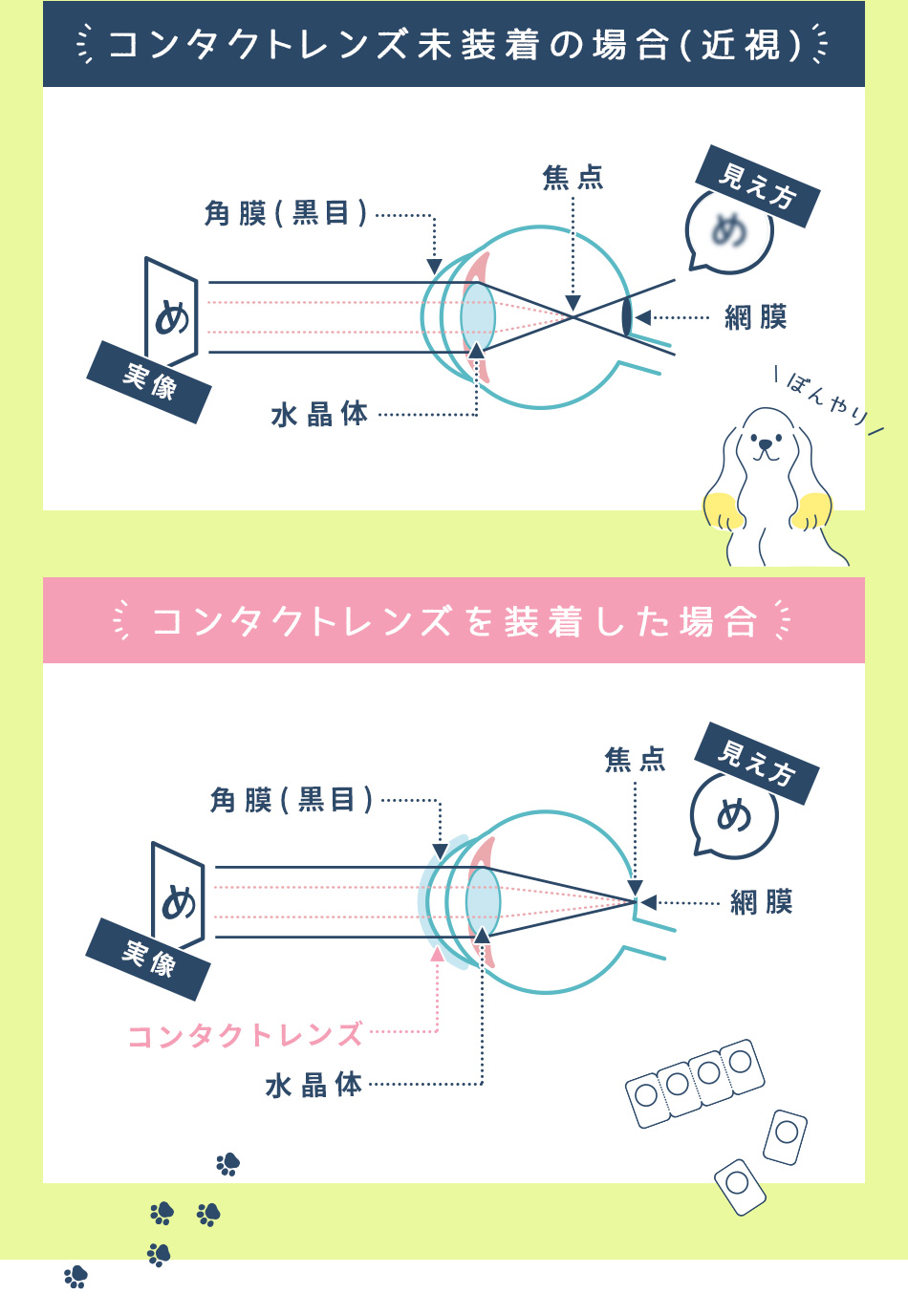 コンタクトレンズを装着・未装着の場合