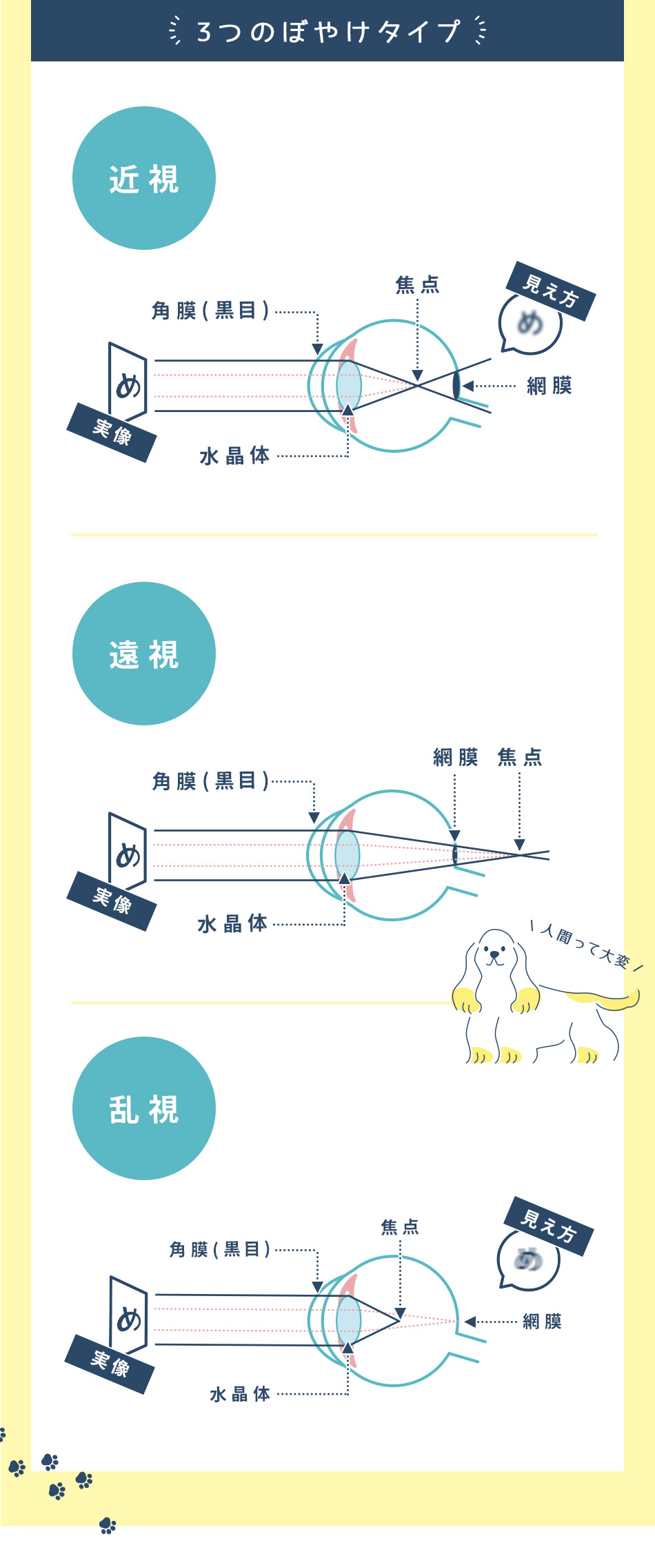 近視遠視乱視とは？