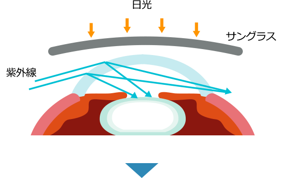 紫外線が隙間から入り込んだ様子