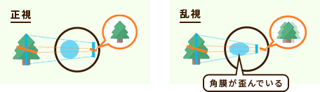 乱視の見え方
